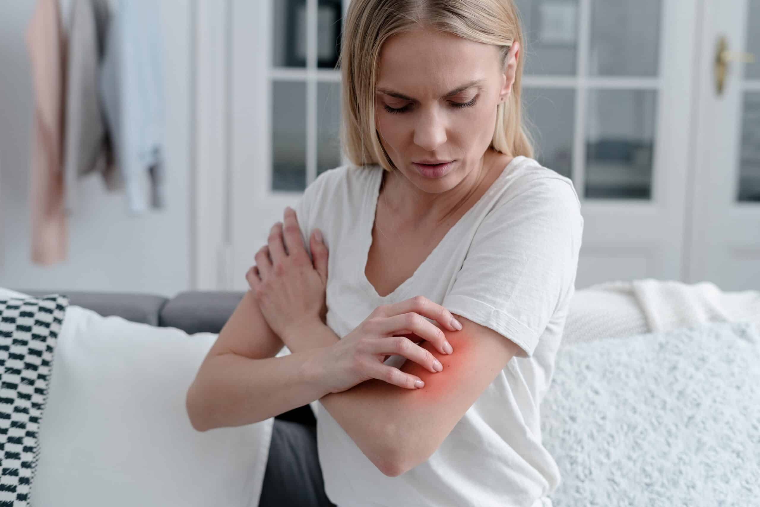 Read more about the article Lawyers Pursue Skin Cancer Cases After Medication Use